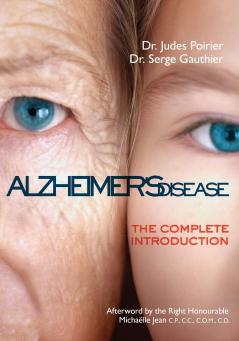Alzheimer's Disease