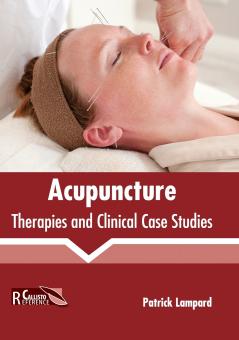 Acupuncture
