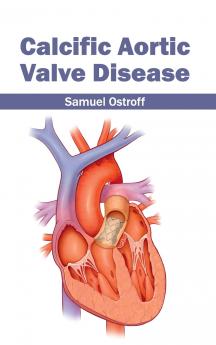 Calcific Aortic Valve Disease