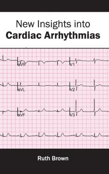 New Insights into Cardiac Arrhythmias