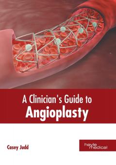 A Clinician's Guide to Angioplasty