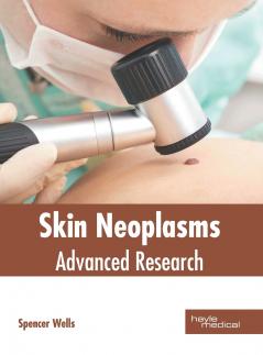 Skin Neoplasms