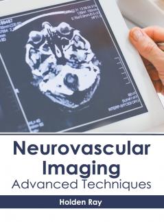 Neurovascular Imaging