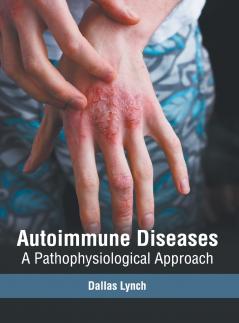 Autoimmune Diseases