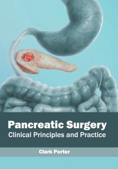 Pancreatic Surgery