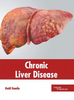 Chronic Liver Disease
