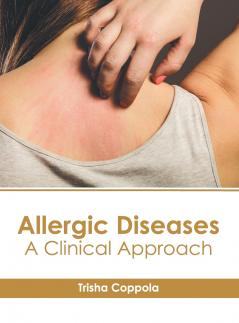 Allergic Diseases