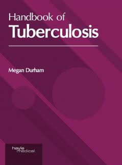 Handbook of Tuberculosis