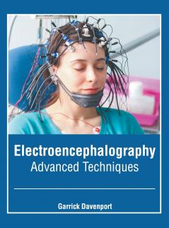 Electroencephalography