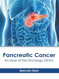 Pancreatic Cancer