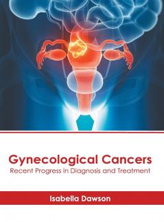 Gynecological Cancers