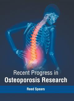 Recent Progress in Osteoporosis Research