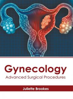 Gynecology