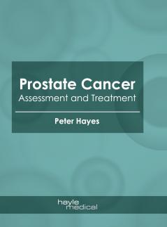 Prostate Cancer