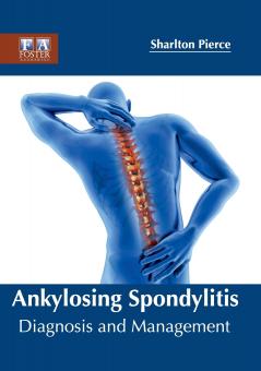Ankylosing Spondylitis
