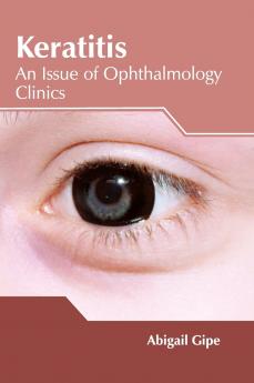 Keratitis