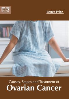 Causes Stages and Treatment of Ovarian Cancer