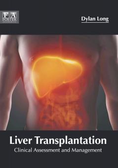 Liver Transplantation