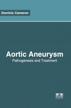 Aortic Aneurysm