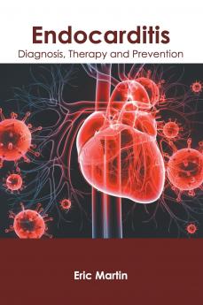 Endocarditis