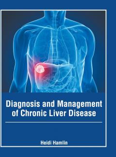 Diagnosis and Management of Chronic Liver Disease