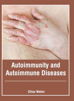 Autoimmunity and Autoimmune Diseases