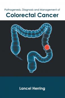 Pathogenesis Diagnosis and Management of Colorectal Cancer