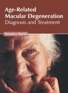 Age-Related Macular Degeneration