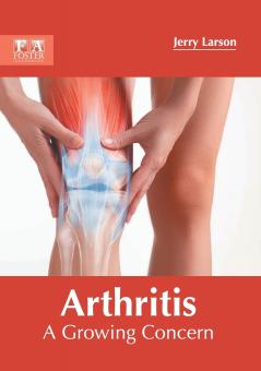 Arthritis