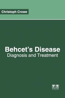 Behcet's Disease