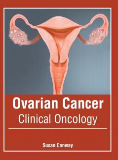 Ovarian Cancer