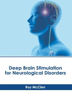 Deep Brain Stimulation for Neurological Disorders