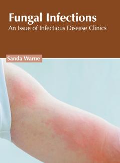 Fungal Infections