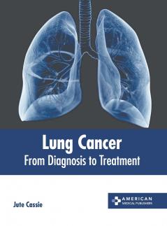 Lung Cancer