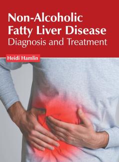 Non-Alcoholic Fatty Liver Disease