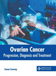 Ovarian Cancer