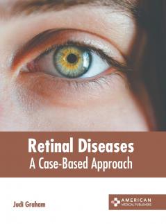 Retinal Diseases