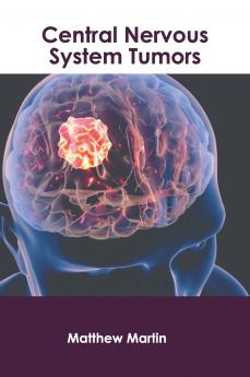 Central Nervous System Tumors
