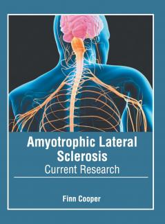 Amyotrophic Lateral Sclerosis