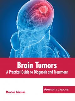 Brain Tumors