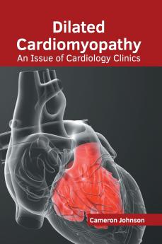 Dilated Cardiomyopathy