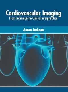 Cardiovascular Imaging