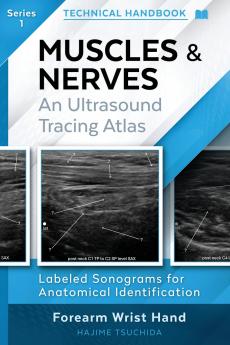 TECHNICAL ULTRASOUND HANDBOOK - MUSCLES & NERVES