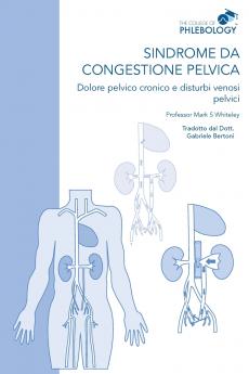 Sindrome da congestione pelvica - Dolore pelvico cronico e disturbi venosi pelvici