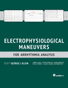 Electrophysiological Maneuvers for Arrhythmia Analysis