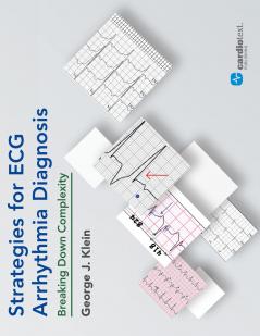 Strategies for ECG Arrhythmia Diagnosis