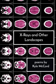 X-Rays and Other Landscapes