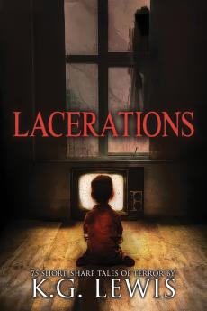 Lacerations