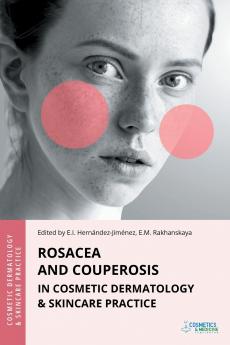 Rosacea and Couperosis in Cosmetic Dermatology & Skincare Practice