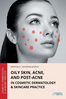 Oily Skin Acne and Post-Acne in Cosmetic Dermatology & Skincare Practice
